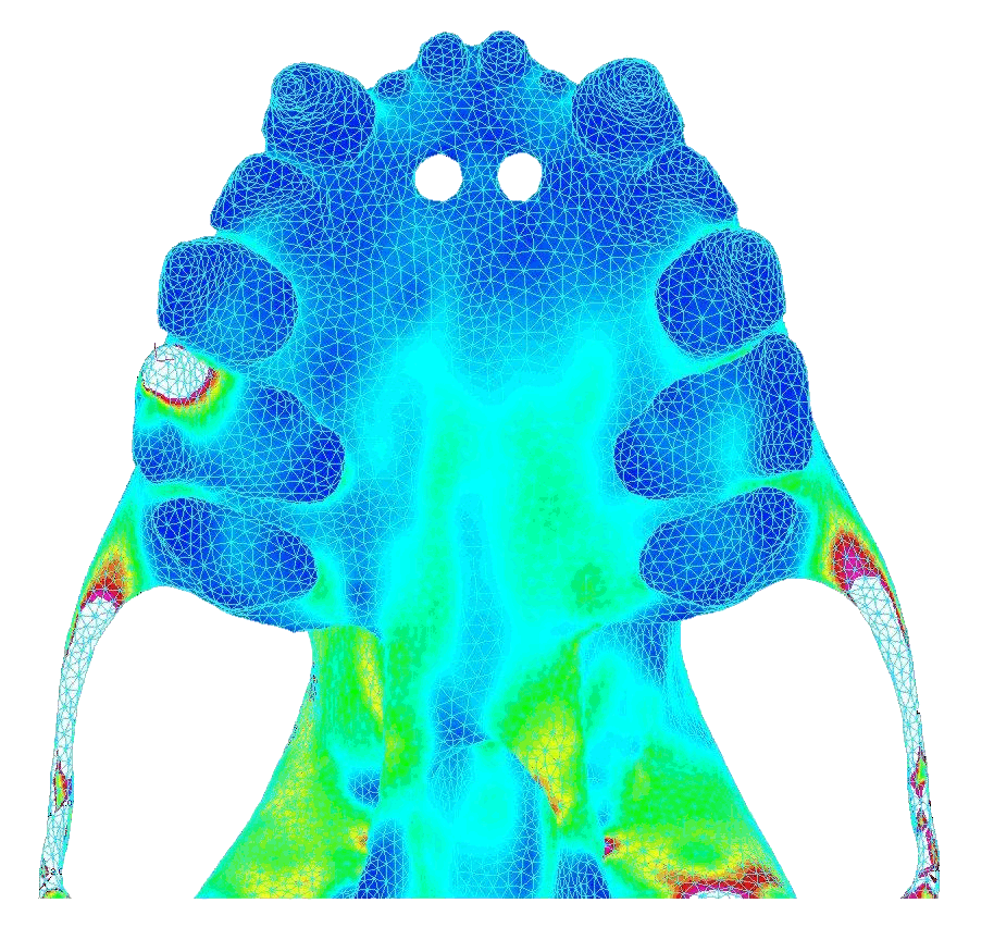 von Mises stress in the palate under the common biting behavior (bite force = 22.5 N)